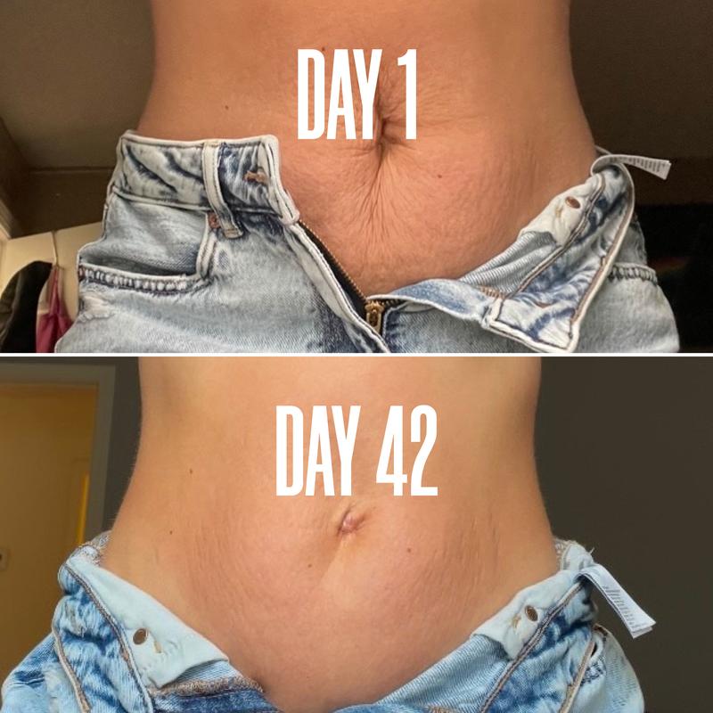 B-FLAT Belly Firming Cream – Visible Results in Just 30 Days🏆