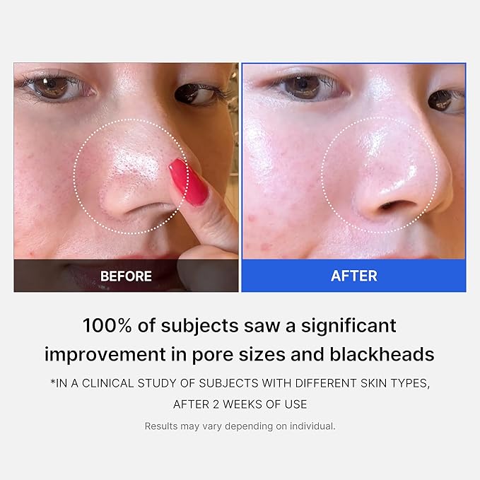 Zero Pore Pads, Dual-Textured Facial Toner Pads for Exfoliation and Pore Care with 4.5% AHA Lactic Acid & 0.45% BHA Salicylic Acid