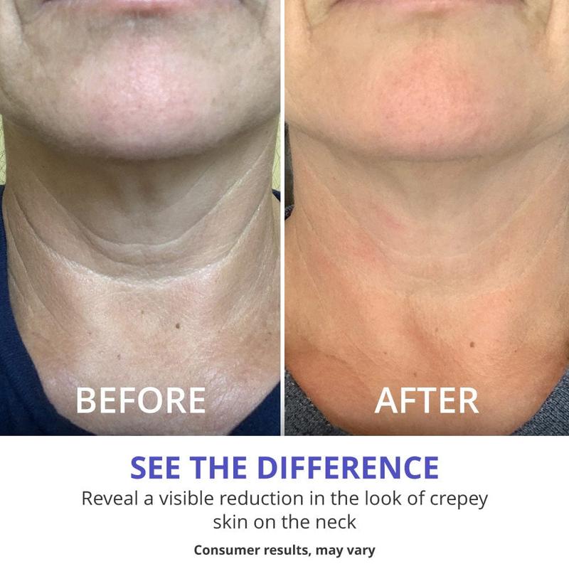 Advanced Anti-aging Neck Cream
