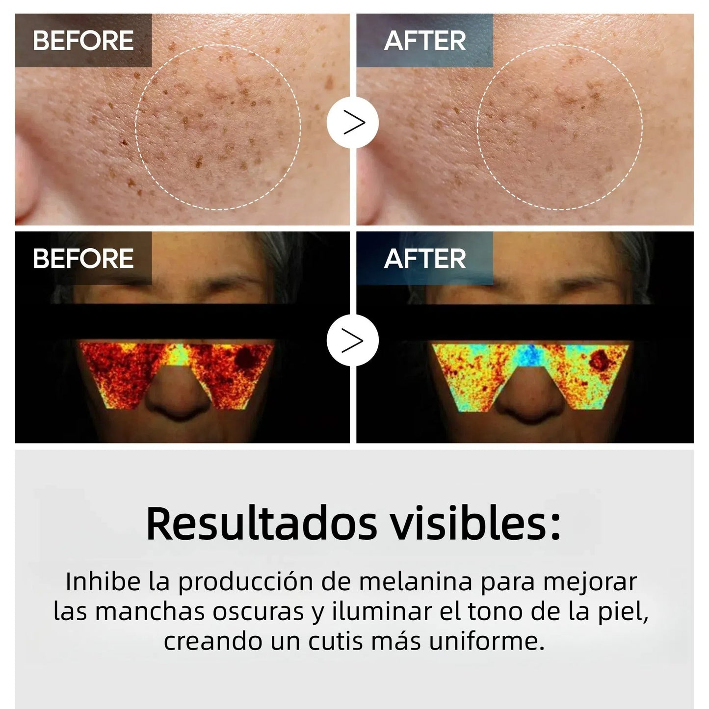 Tranexamic Acid TX Cream | Cream for Freckles, Dark Spots, and Anti-Pigmentation