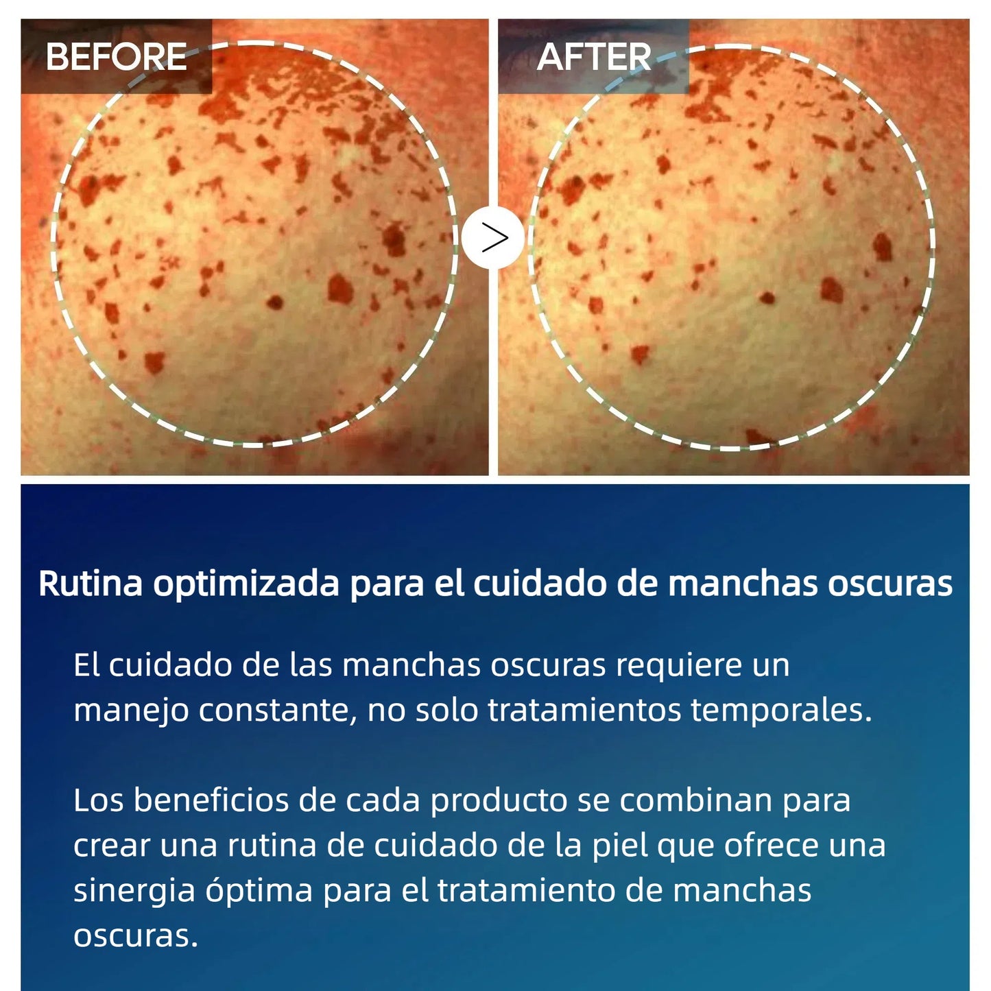 Tranexamic Acid TX Cream | Cream for Freckles, Dark Spots, and Anti-Pigmentation