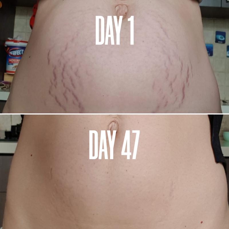 B-FLAT Belly Firming Cream – Visible Results in Just 30 Days🏆