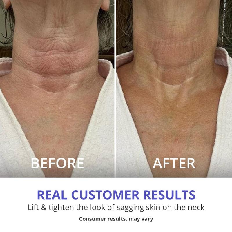 Advanced Anti-aging Neck Cream