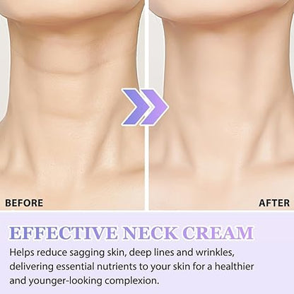 Advanced Anti-aging Neck Cream
