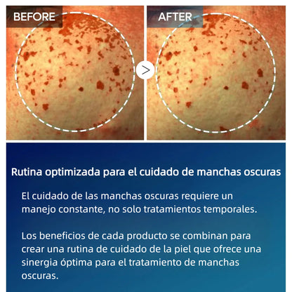 Tranexamic Acid TX Cream | Cream for Freckles, Dark Spots, and Anti-Pigmentation