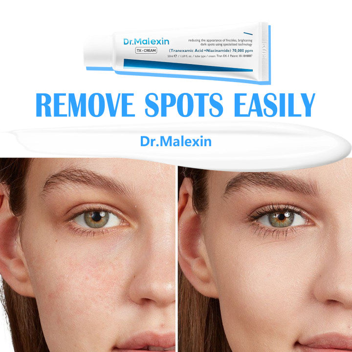 Tranexamic Acid TX Cream | Cream for Freckles, Dark Spots, and Anti-Pigmentation